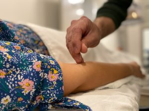 A man sticks a needle in a woman's arm as part of an acupuncture session.